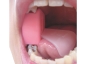 Preview: Bloque de mordida "Mouth Prop" con retenedor lingual, tamaño L