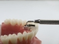 Preview: Puntas de recambio Tiger Dental MiniMold (molde de mordida palatina)