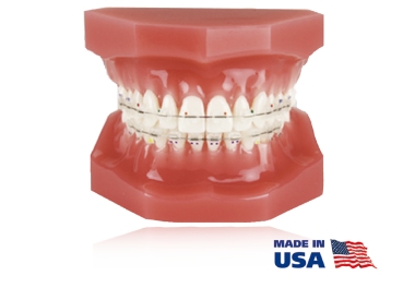 Style (composite), Brackets individuales, MBT* .018"